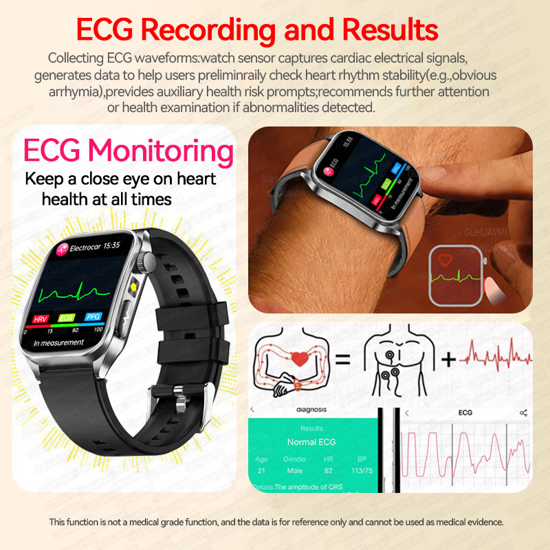 นาฬิกาสมาร์ทวอทช์รุ่นใหม่ปี 20 - Fall Detection Watch บทวิจารณ์และราคา